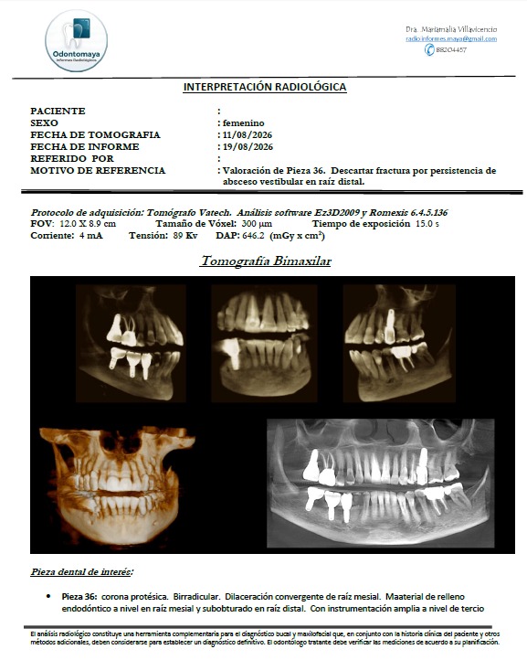 Ejemplo de informe radiológico de Odontomaya